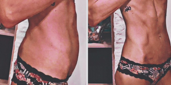 Da un Colon Ingovernabile.. A un Pavimento Pelvico da Urlo